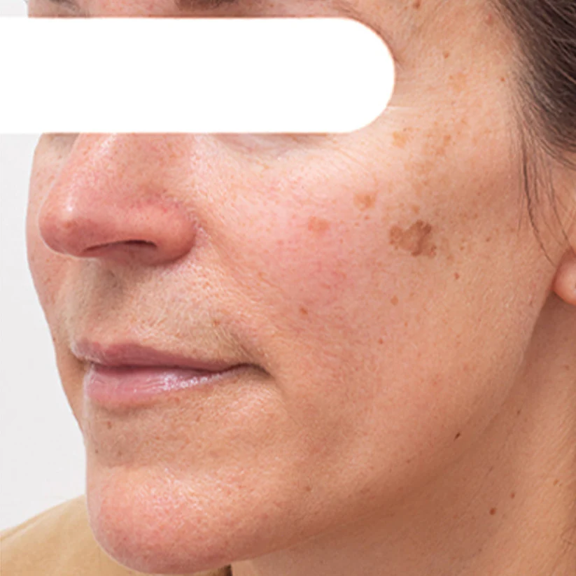 AEXZRยฎ Herbal Spots โ
๐ค๐๐ง๐ ๐ฆ๐ก ๐ฅ๐ ๐๐% Peel-Off Facial Mask