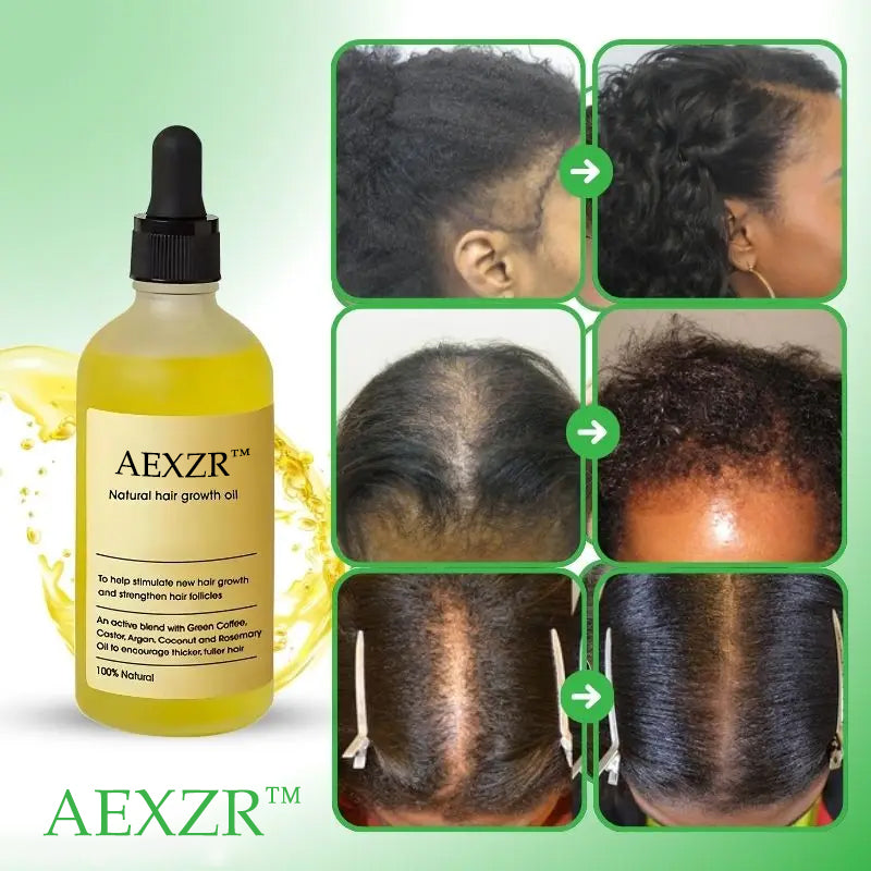 AEXZR™ Natural Hair Growth Serum - 🔥🔥Revive Your Natural Hair in 2 Weeks!🔥🔥