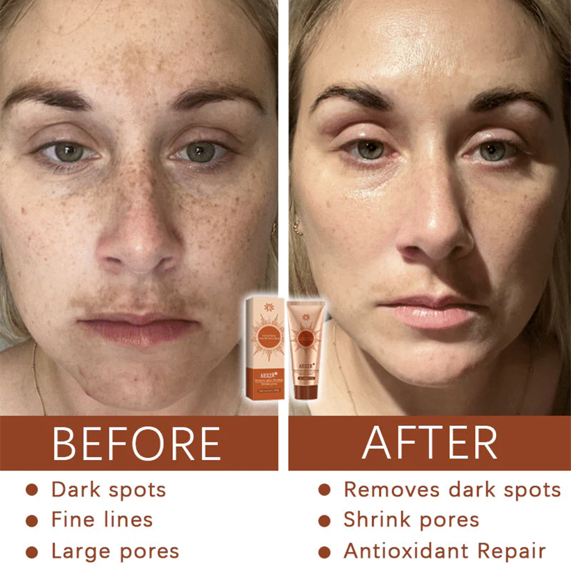 AEXZRยฎ Herbal Spots โ
๐ค๐๐ง๐ ๐ฆ๐ก ๐ฅ๐ ๐๐% Peel-Off Facial Mask