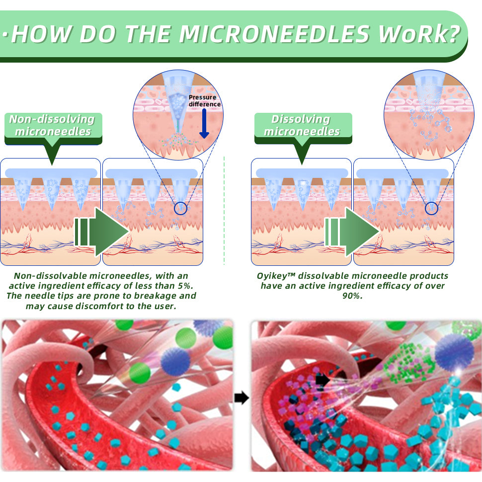 [See results in 7 days]💋Cvreoz® SMGT-GLP-1 Nano Microneedle Patch(Painless, long-lasting, addressing diabetes, obesity, and cardiovascular diseases)💧