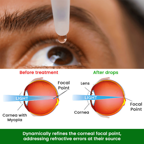 AEXZR™ Myopia Cure Drops - 👩‍⚕️ Recommended by Experts! 🔥 Grab Your 80% Limited Discounts Today! 💰