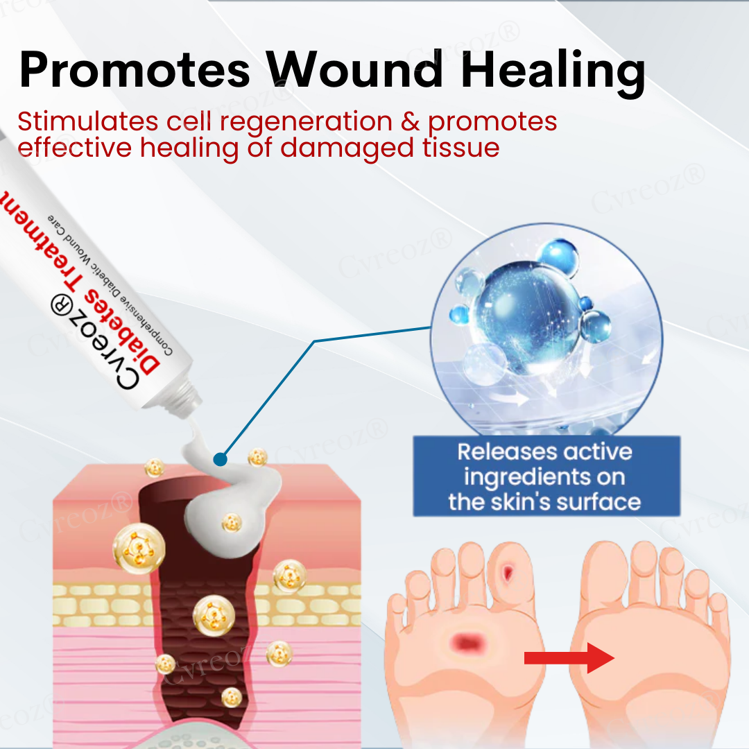 Cvreoz® Diabetes Treatment Cream