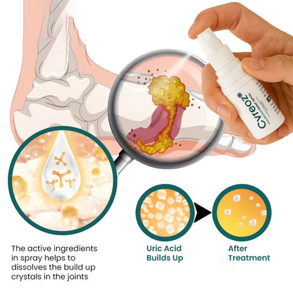 New Arrival🔥Cvreoz® GoutEase Relief Spray - Already Helped 120,000+ Users Reclaim Their Comfort✅