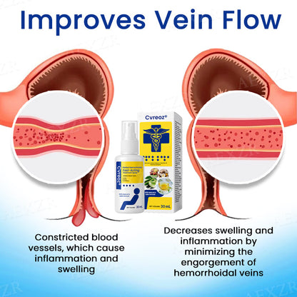 🌟 Official Store | Cvreoz® Herbal Hemorrhoids Fast-Acting Treatment Spray – Your Quick Relief Solution!