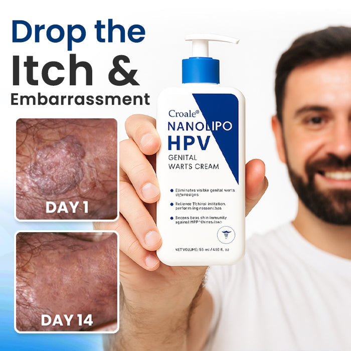⭐FDA Approved⭐ WHO Approved✅ Croaie® NanoLipo HPV Genital Warts Cream - No allergies🌸 quick and effective⚡️ with over 150,000 sold📦