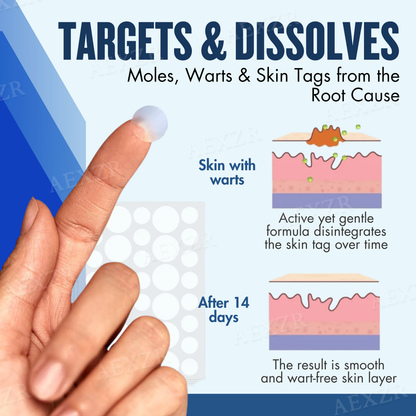 Skinetiv™ -🆂🅰🆅🅴 🆄🅿 🆃🅾 80% 🅾🅵🅵- Moles & Warts Removing Skin Tag Patch