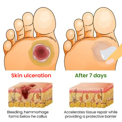 🌟 Official Store | Cvreoz® Diabetes Treatment Cream🔥 Reclaim Your Skin Health Today!