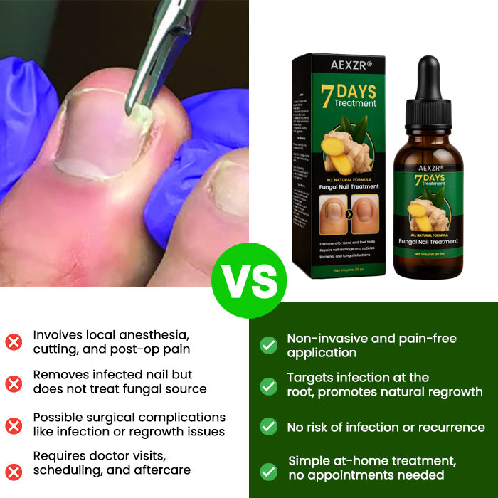🔥 Official Store | AEXZR® Fungal Nail Treatment✅ Say Goodbye to Fungal Infections and Hello to Healthy Nails!