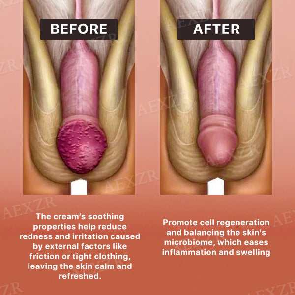 AEXZR™ Glans Care Cream - Recommended and Trusted by Experts!