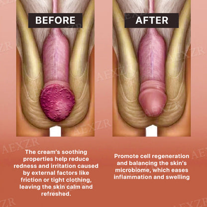 AEXZR™ Glans Care Cream - Recommended and Trusted by Experts!