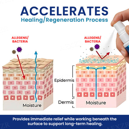 🔥Hot Sales - 50% OFF🔥Cvreoz® Genital Treatment Spray