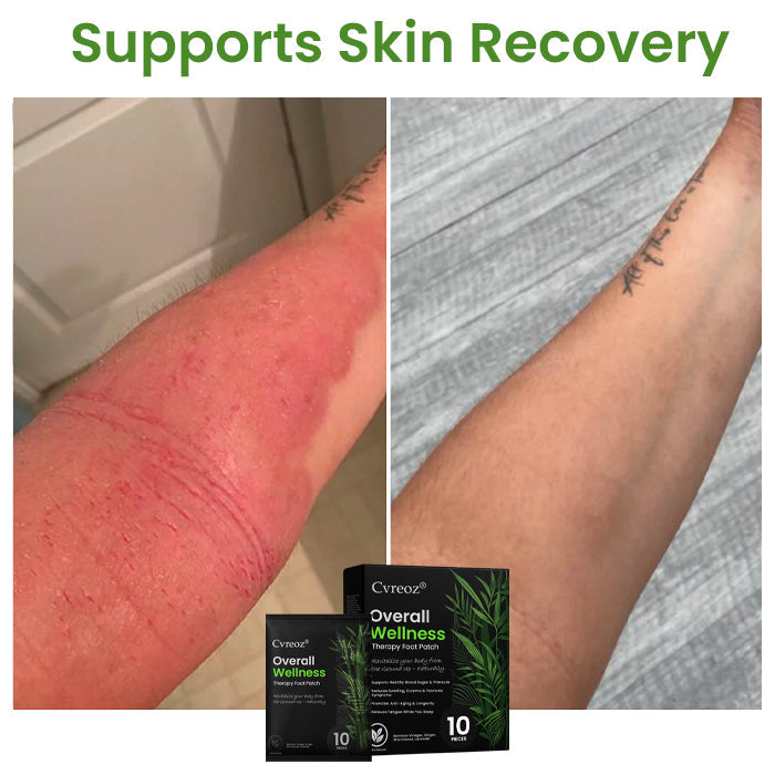 🌟 Official Store | Cvreoz® Overall Wellness Therapy Foot Patch🌿 Revitalize Your Health from the Ground Up!