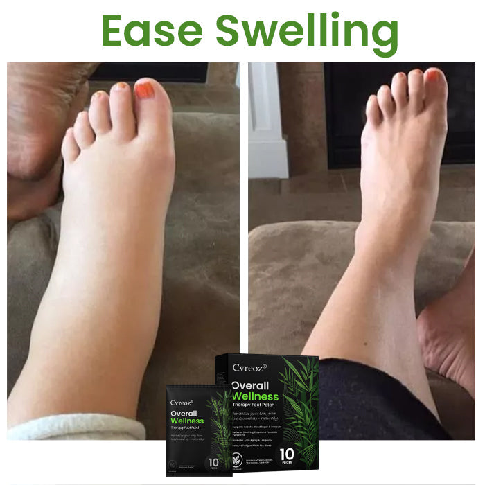 🌟 Official Store | Cvreoz® Overall Wellness Therapy Foot Patch🌿 Revitalize Your Health from the Ground Up!