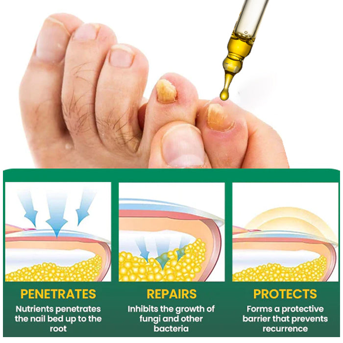 🔥 Official Store | AEXZR® Fungal Nail Treatment✅ Say Goodbye to Fungal Infections and Hello to Healthy Nails!