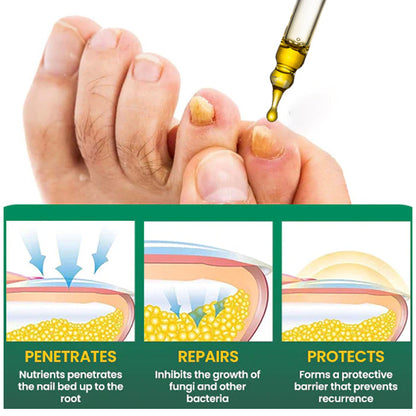 🔥 Official Store | AEXZR® Fungal Nail Treatment✅ Say Goodbye to Fungal Infections and Hello to Healthy Nails!