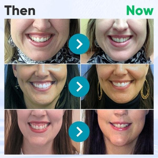 AEXZR™ 🎉 LIMITED TIME OFFER 🎉 Gum Therapy Gel