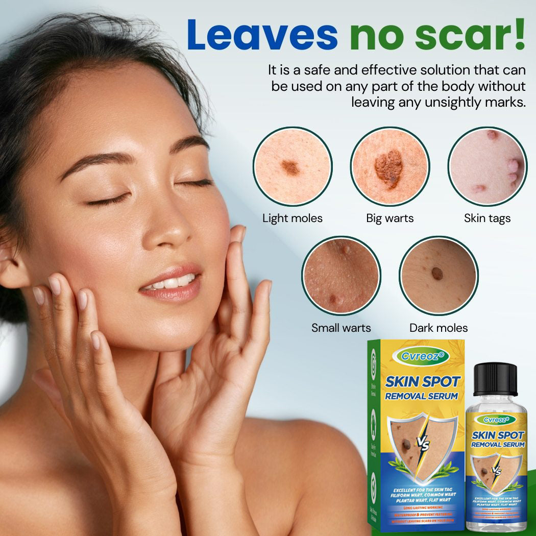 Cvreoz® Skin Spot Removal Serum