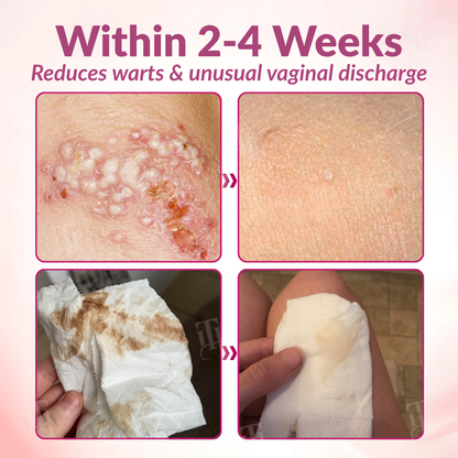 🌟 Official Store | Piguiay® Femina HPV Relief Capsules – Unlock Comfort and Confidence!