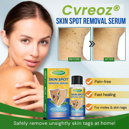 Cvreoz® Skin Spot Removal Serum