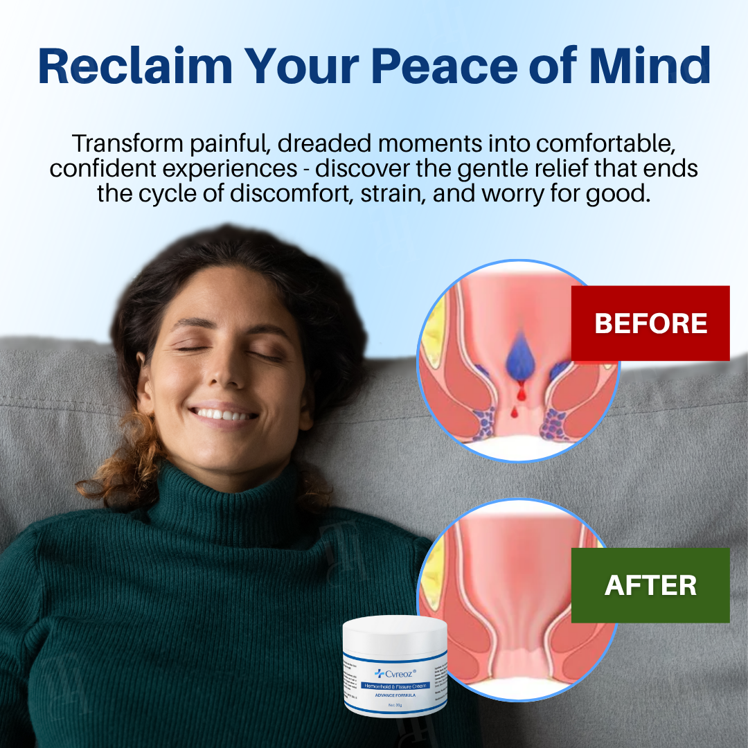 🌟 Official Store | LAST 31 PCS LEFT!🔥Hot Sale - 50% OFF🌿Cvreoz® Hemorrhoid & Fissure Cream