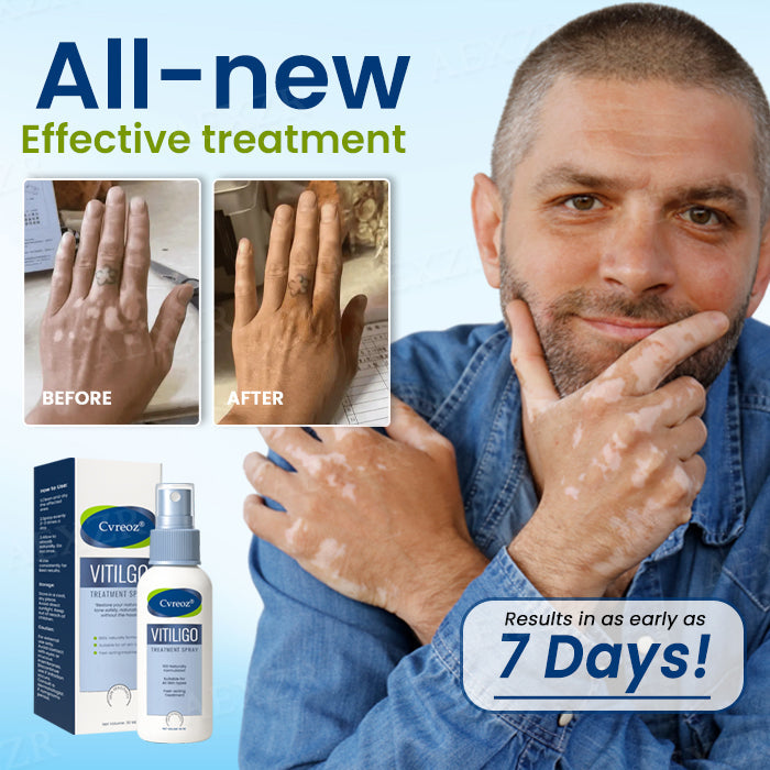 🔥Hot Sales - 50% OFF🔥Cvreoz® Vitiligo Treatment Spray