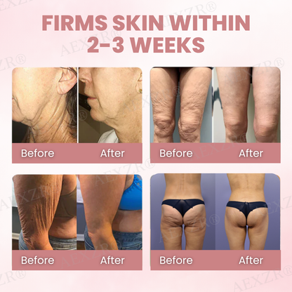 🌟 Official Store | AEXZR® Body Skin Firming Cream💕 Reclaim Your Skin’s Firmness and Youthful Glow!