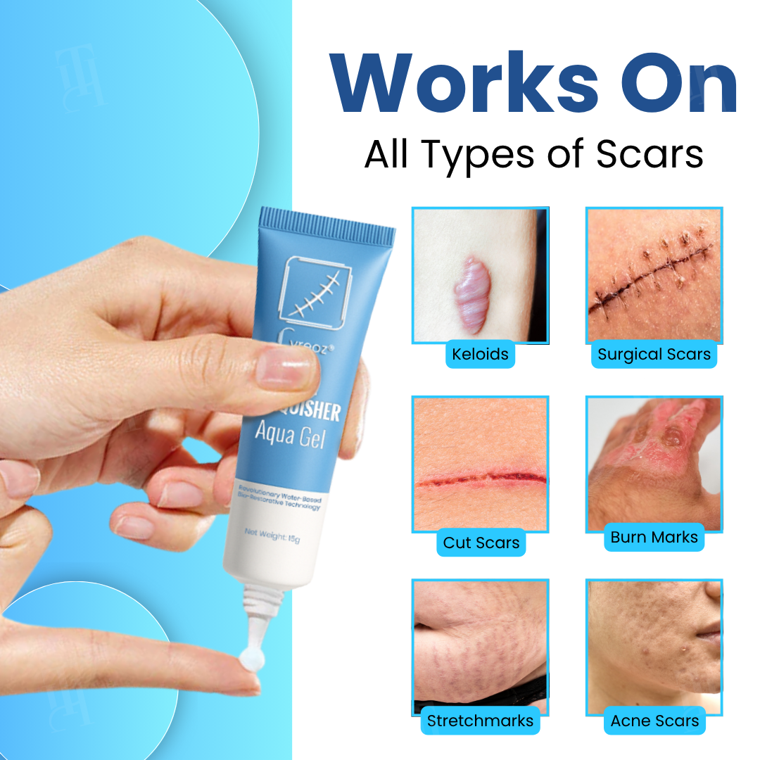 🌟 Official Store |🔥LAST 22 PCS LEFT |🔥Hot Sale - 50% OFF🌿Cvreoz® Scar Vanquisher Aqua Gel