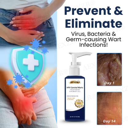 🔥Hot Sales - 50% OFF🔥AEXZR® HPV Genital Warts Treatment Shower Gel