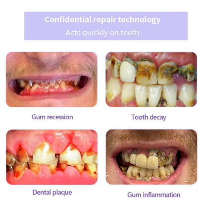 AEXZR™ Teeth Restoration Mineral Powder - 🦷 Restore, Repair, Smile Brighter!😁