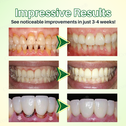 🌟 Official Store | Cvreoz® Propolis Oral Health Spray – Your Natural Solution for Healthy Gums!