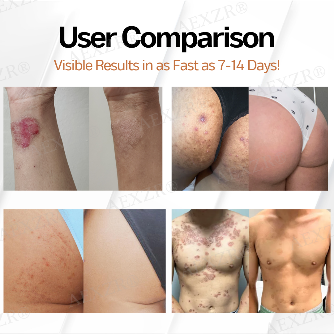 AEXZR® New Zealand Manuka Honey All-in-One Cream