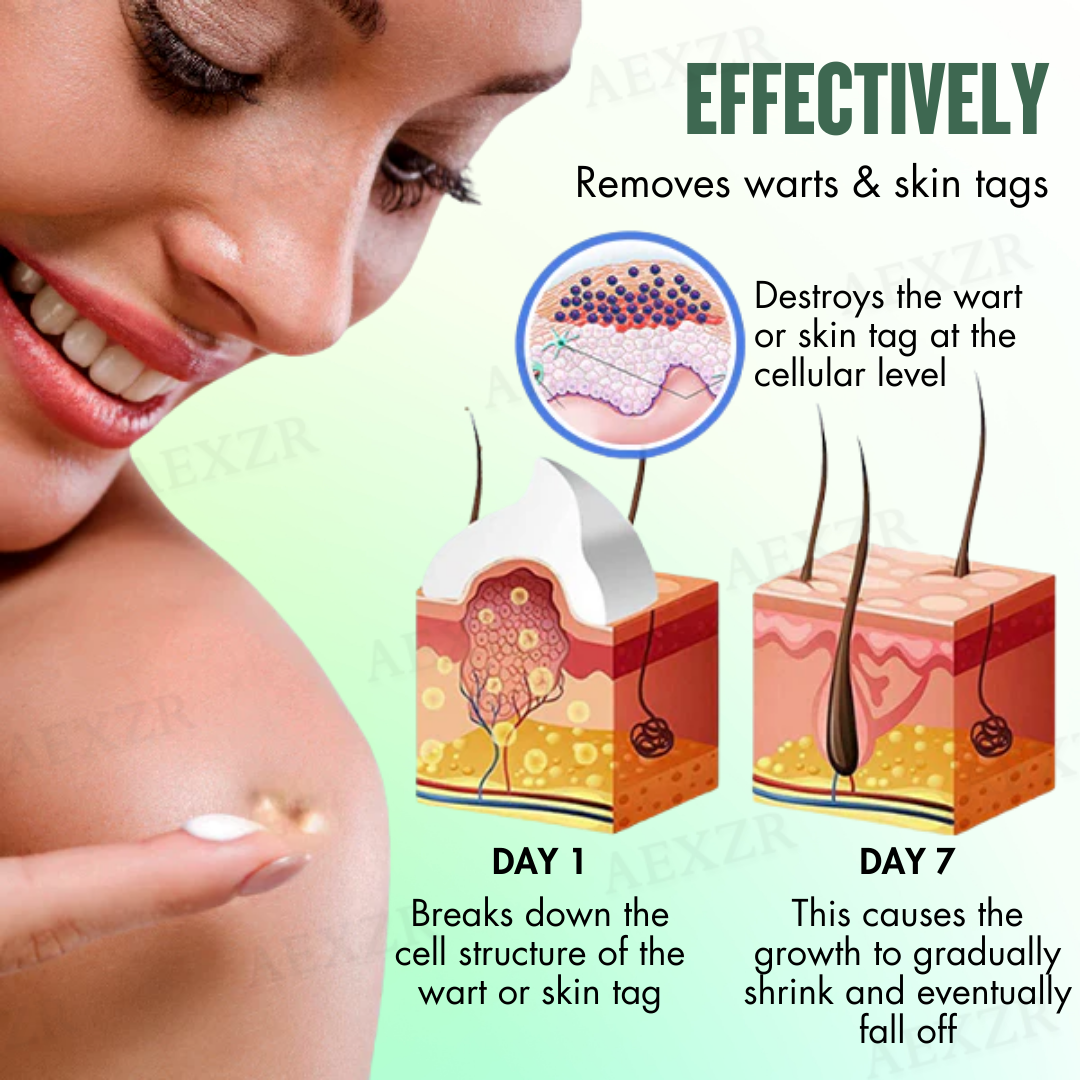 Dermazi™ -🆂🅰🆅🅴 🆄🅿 🆃🅾 8️⃣0️⃣% 🆃🅾🅳🅰🆈-  Instant Blemish Removal Cream