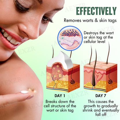Dermazi™ -🆂🅰🆅🅴 🆄🅿 🆃🅾 8️⃣0️⃣% 🆃🅾🅳🅰🆈-  Instant Blemish Removal Cream