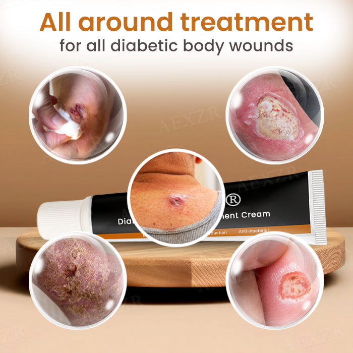 Cvreoz® 🎉🅻🅸🅼🅸🆃🅴🅳 🆃🅸🅼🅴 🅾🅵🅵🅴🆁🎉 Diabetes Treatment Cream