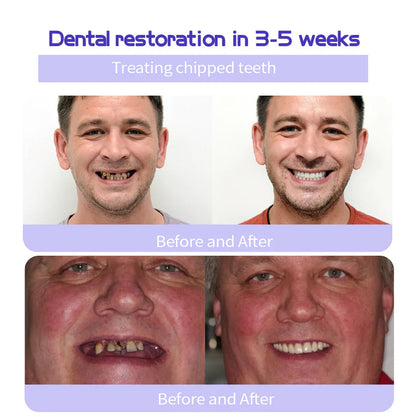 AEXZR™ Teeth Restoration Mineral Powder - 🦷 Restore, Repair, Smile Brighter!😁