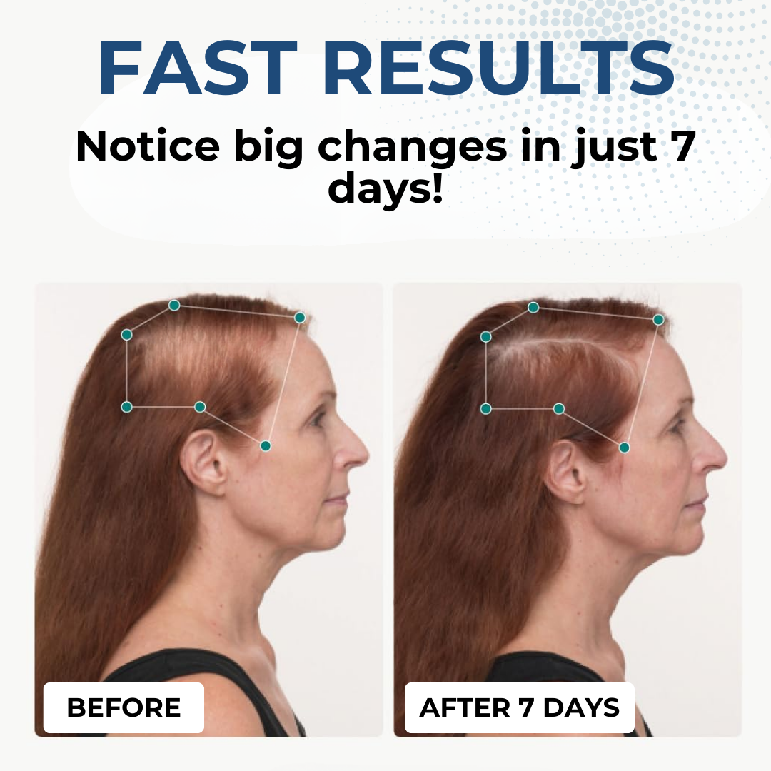 HairGenix™ Hair Regrowth Capsules 👩‍🦰Your Pathway to Fuller, Healthier Hair!👨‍🦰 Grab your discounts TODAY!⚡⚡