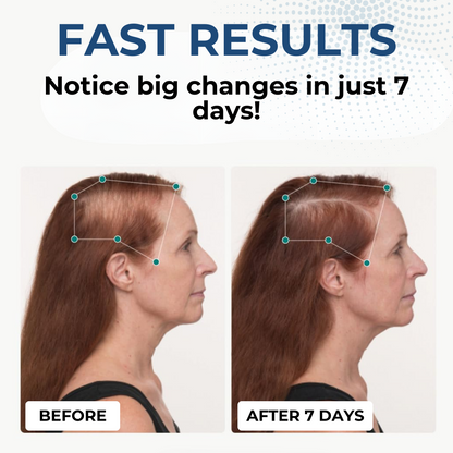 HairGenix™ Hair Regrowth Capsules 👩‍🦰Your Pathway to Fuller, Healthier Hair!👨‍🦰 Grab your discounts TODAY!⚡⚡