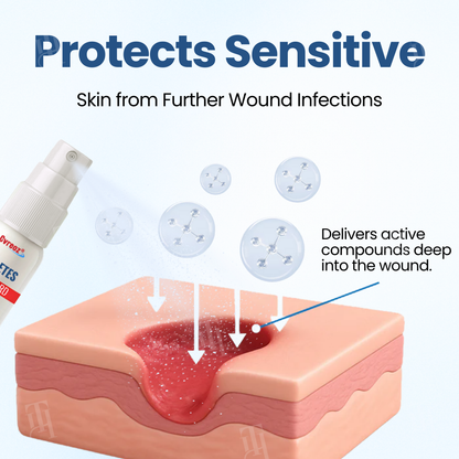 🔥Hot Sales - 50% OFF🔥Cvreoz® Diabetes Foot Guard Recovery Spray