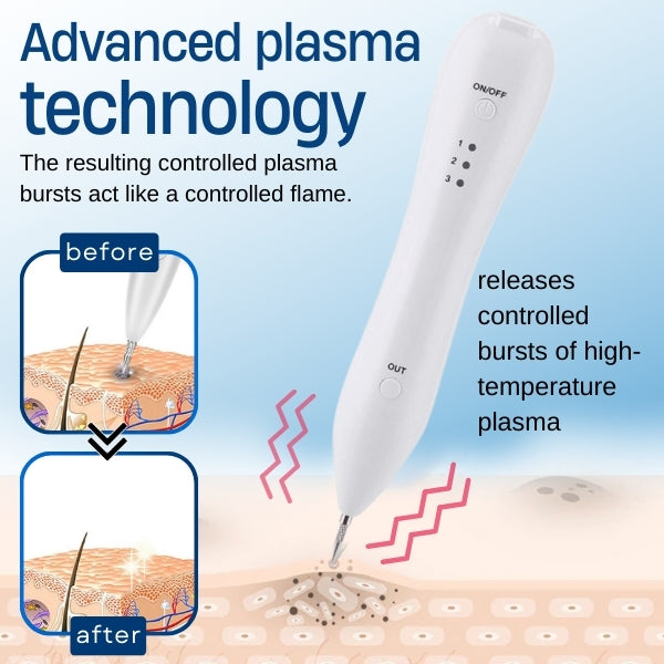 Official Store | Bikenda® Skin Tag Treatment Pen✅Just once a week, visible changes in 7 days🔥