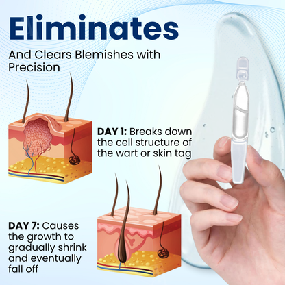 🌟 Best-Selling Product 2025🌟Unlock Flawless Skin with Cvreoz® Skin Radiant Care Drops! 🌟 Say Goodbye to Imperfections!