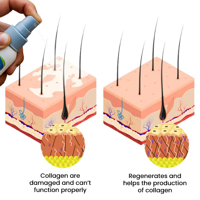 🔥Hot Sales - 50% OFF🔥Cvreoz® Vitiligo Treatment Spray