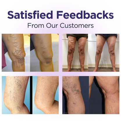 🔥Hot Sale - 50% OFF🌿Cvreoz® DiaLeg Care Cream