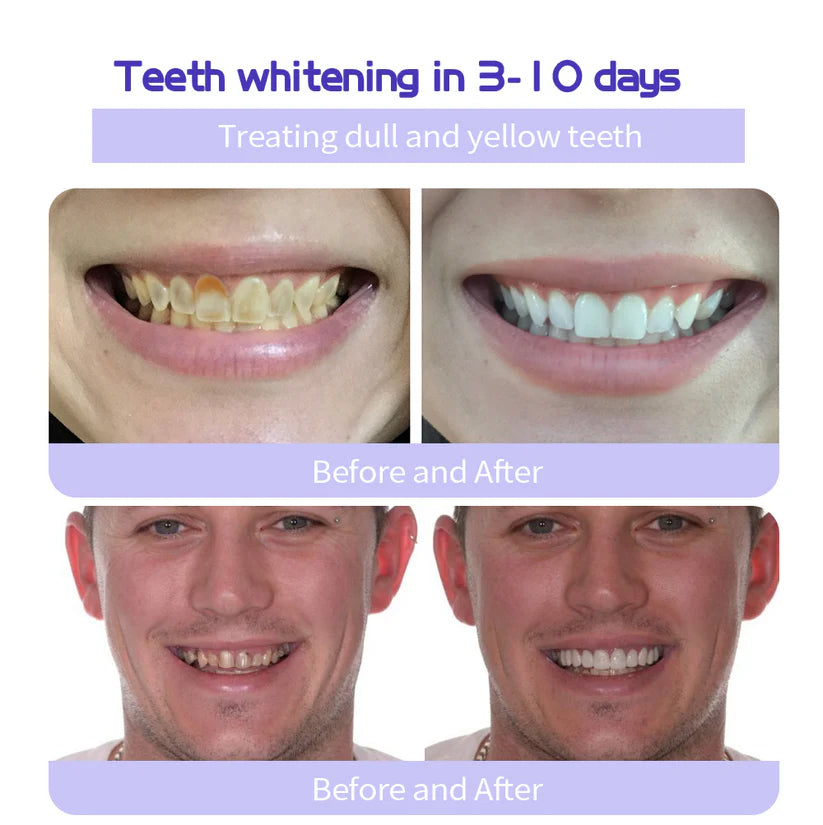 AEXZR™ Teeth Restoration Mineral Powder - 🦷 Restore, Repair, Smile Brighter!😁