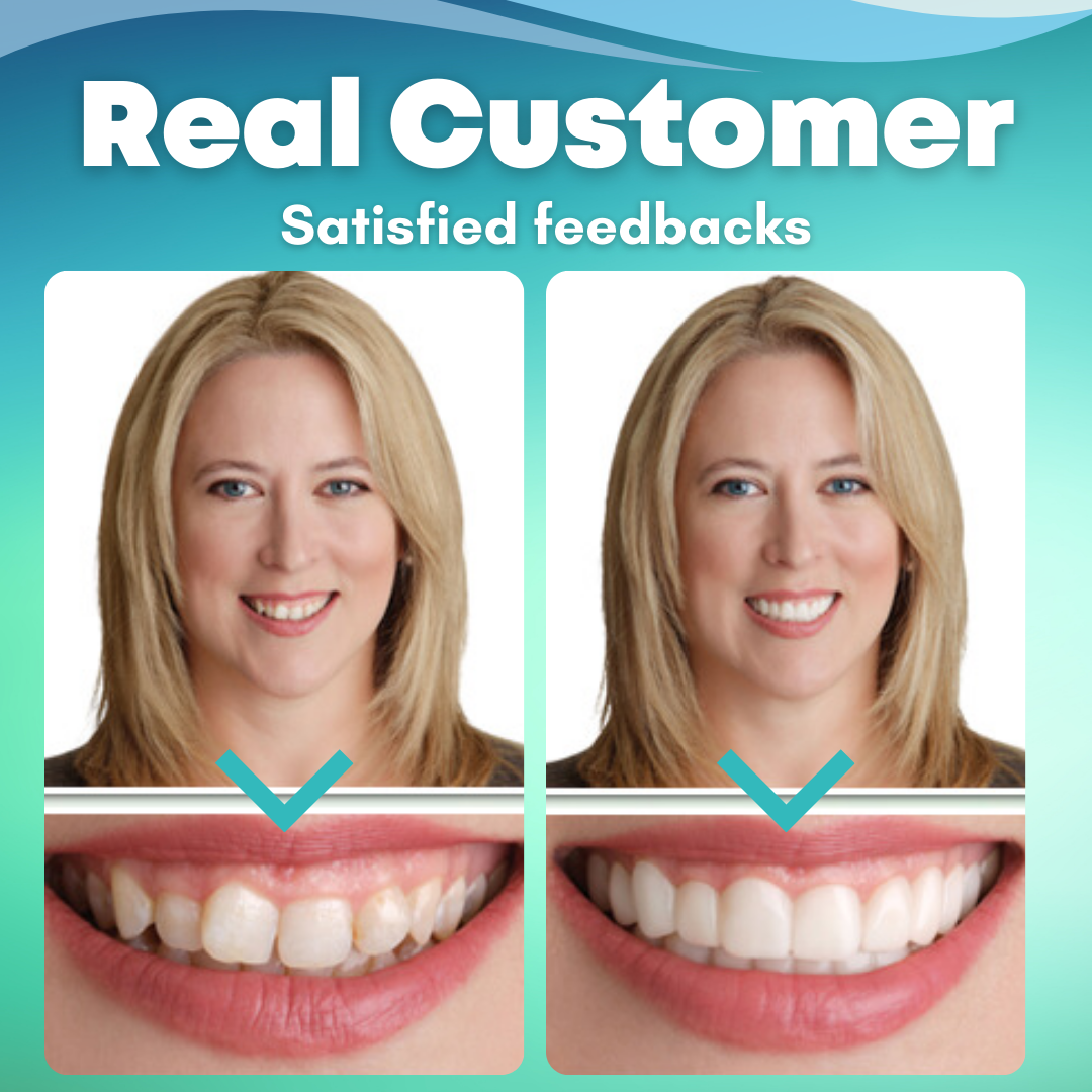 EzySmile™ is 𝕐𝕠𝕦𝕣 𝕀𝕟𝕤𝕥𝕒𝕟𝕥 ℙ𝕒𝕥𝕙 to a Brilliant 🆂🅼🅸🅻🅴!😬😎