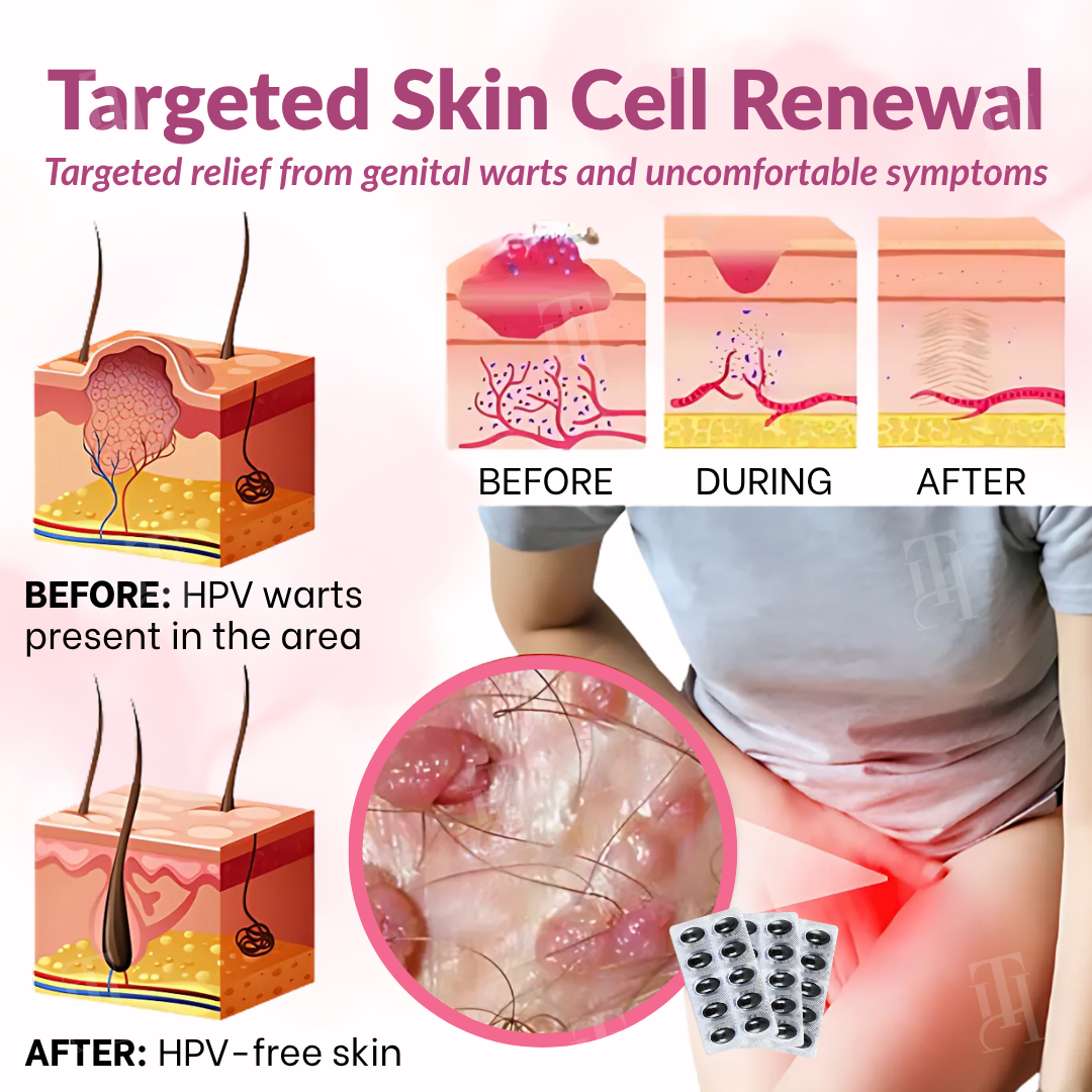 🌟 Official Store | Piguiay® Femina HPV Relief Capsules – Unlock Comfort and Confidence!