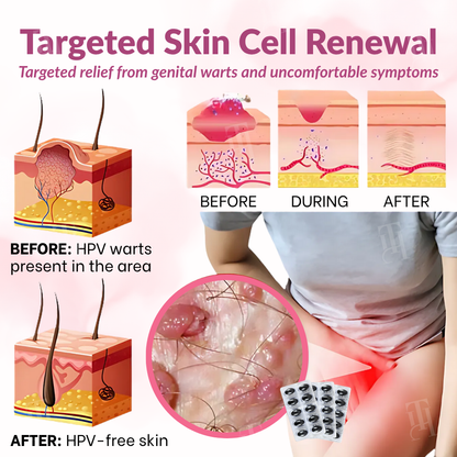 🌟 Official Store | Piguiay® Femina HPV Relief Capsules – Unlock Comfort and Confidence!