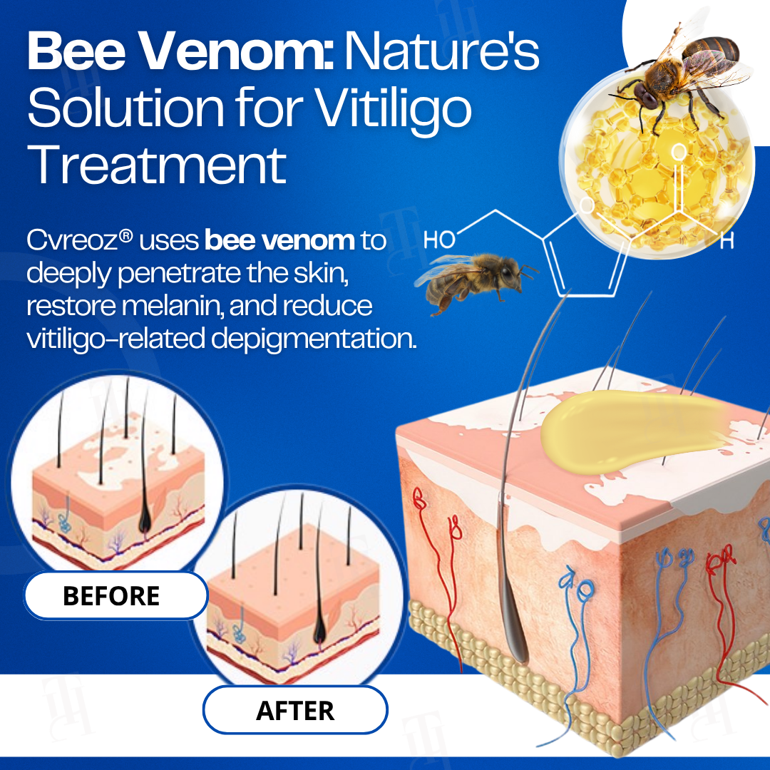 🔥Hot Sales - 50% OFF🐝Cvreoz® VitiClear Bee Venom Cream