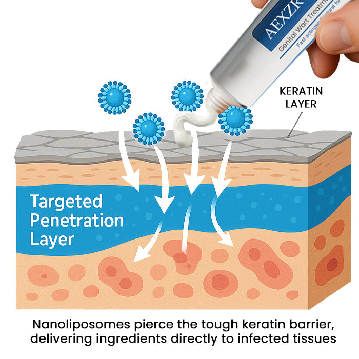 AEXZR® HPV Genital Wart Treatment Cream  ✅ 70% Off! Ends in 10 Minutes💨💙
