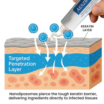 AEXZR® HPV Genital Wart Treatment Cream  ✅ 70% Off! Ends in 10 Minutes💨💙