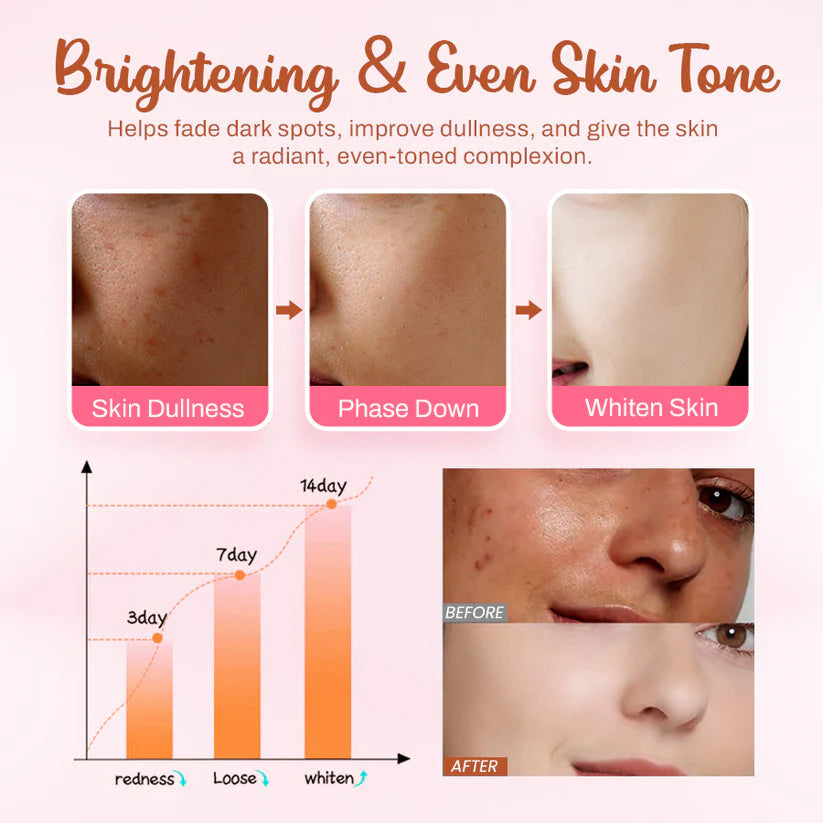 AEXZR® ✅ 𝕤𝕒𝕧𝕖 𝕦𝕡 𝕥𝕠 𝟟𝟘% Whitening and Freckle - Removing Mask